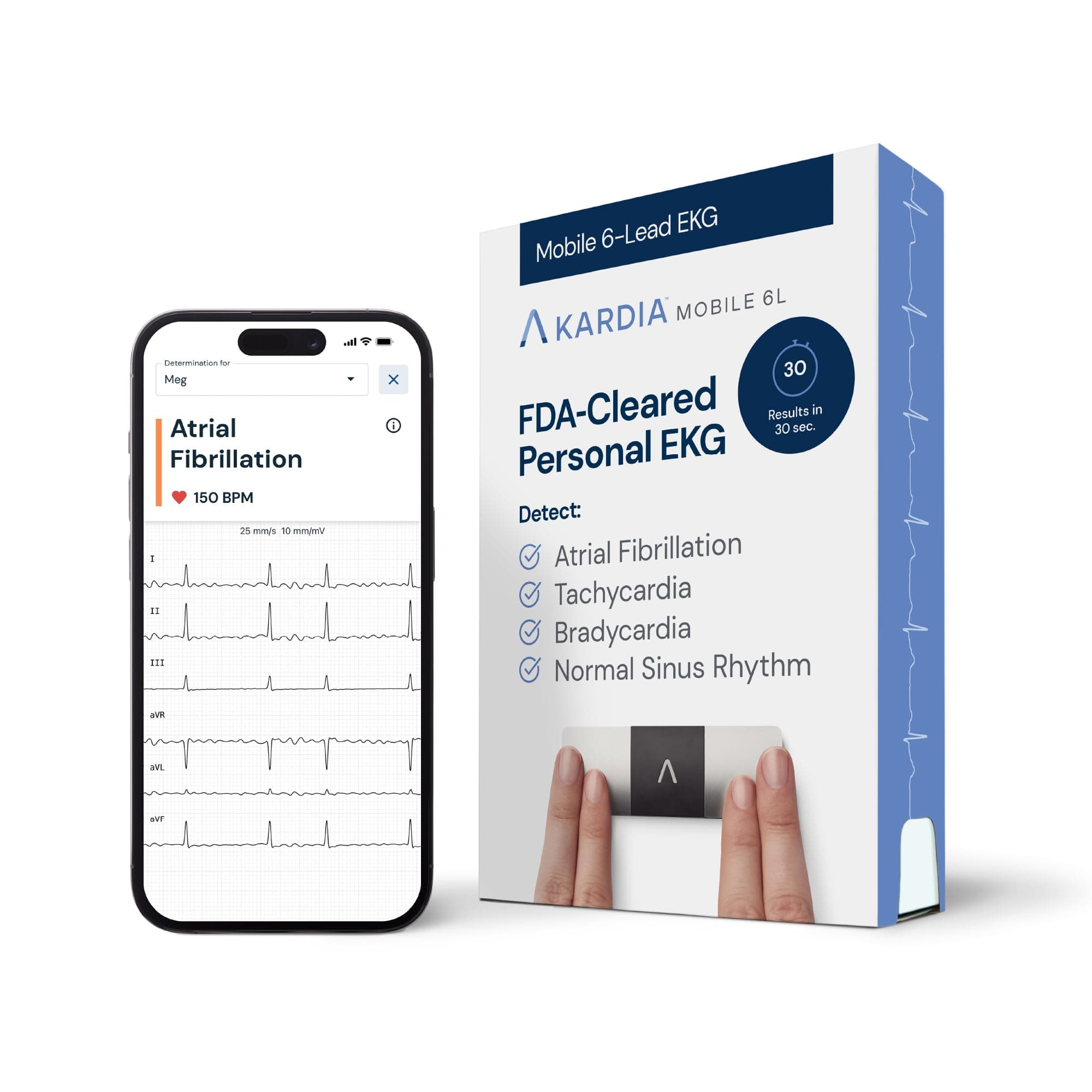 AliveCor KardiaMobile 6L ECG di livello medico | L’ECG Portatile a 6 Derivazioni | Rileva la Fibrillazione Atriale, Bradicardia e Tachicardia in Soli 30 Secondi | Distribuito da OMRON