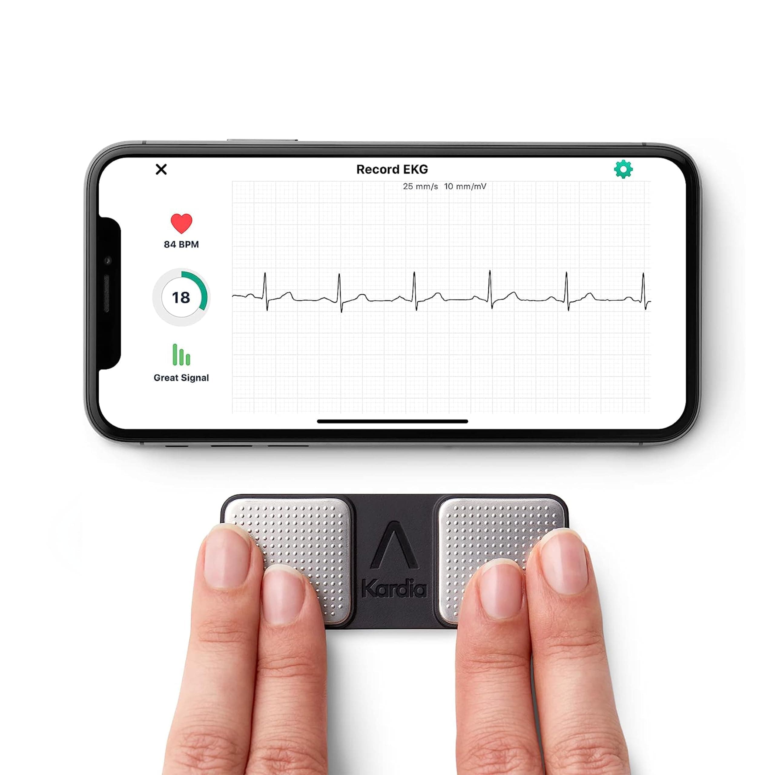 AliveCor KardiaMobile - Le moniteur ECG personnel connecté - Détectez la fibrillation auriculaire en seulement 30 secondes - à tout moment, n'importe où - Distribué par OMRON